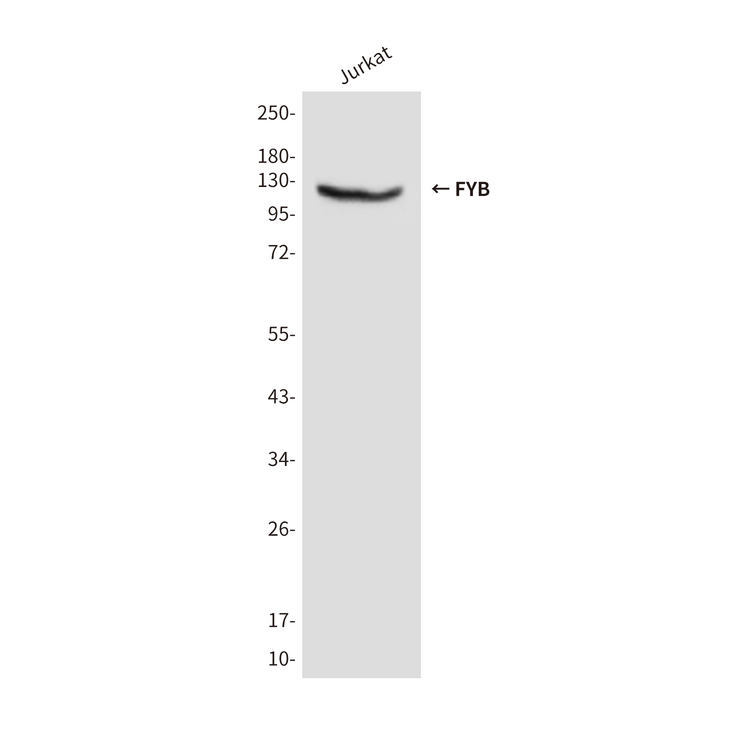Anti-FYB Mouse mAb [41K45M64]