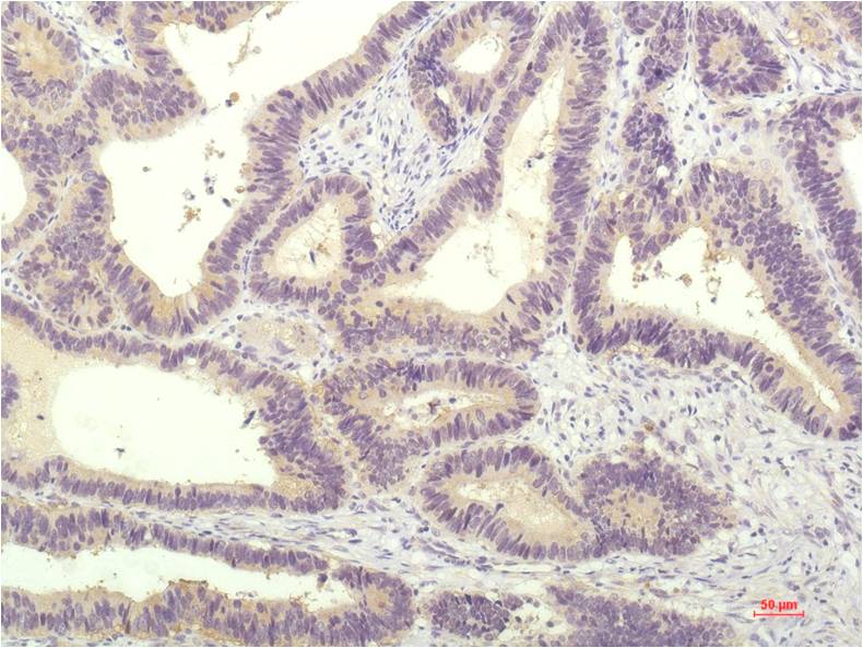 Anti-STAT1 Mouse mAb [40L88L92]