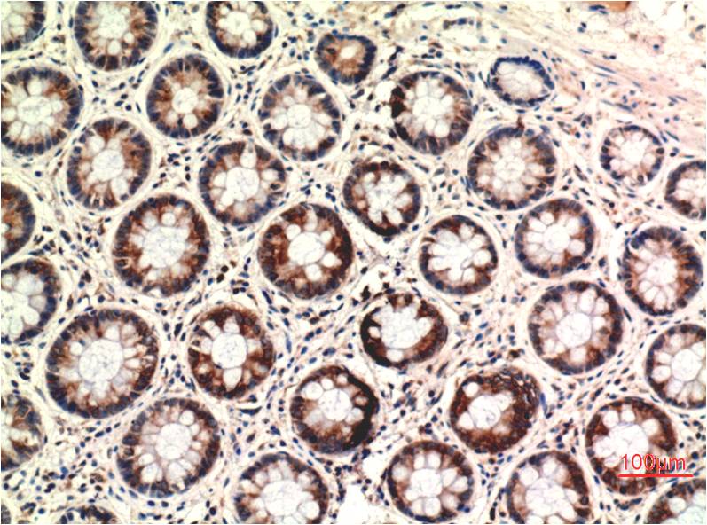 Anti-PTEN Mouse mAb [52M08L12]