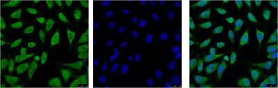 Anti-Hsp70 1A Mouse mAb [63L71L52]