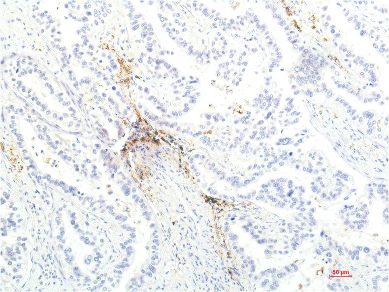 Anti-JAK1 Mouse mAb [99M76L70]