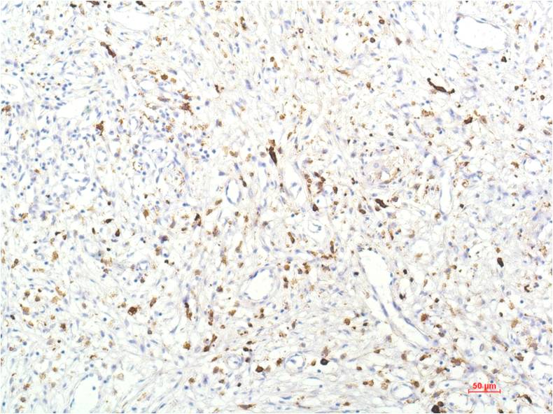 Anti-JAK1 Mouse mAb [99M76L70]