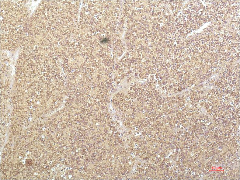 Anti-SGK1 Mouse mAb [28L03M53]