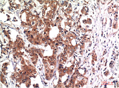 Anti-GSK3 beta Mouse mAb [69M55K79]