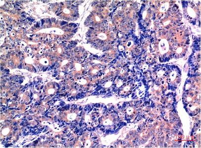 Anti-GSK3 beta Mouse mAb [69M55K79]