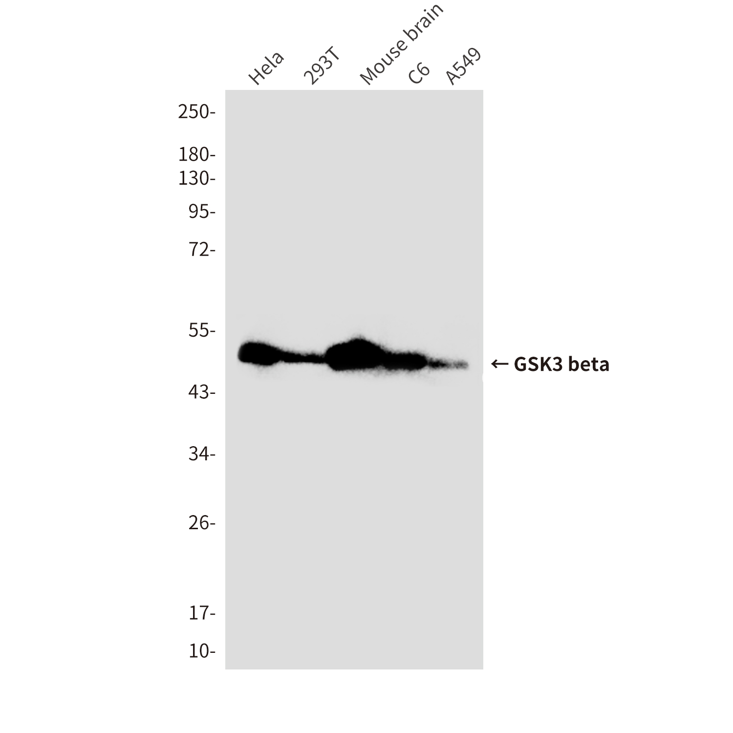 Anti-GSK3 beta Mouse mAb [69M55K79]