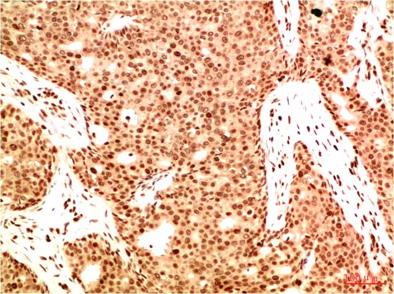 Anti-Acetyl-NF-KB p65 (Lys314/Lys315) Mouse mAb [97K83L75]