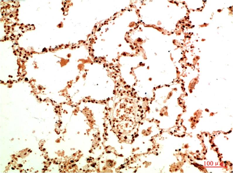 Anti-Acetyl-NF-KB p65 (Lys314/Lys315) Mouse mAb [97K83L75]