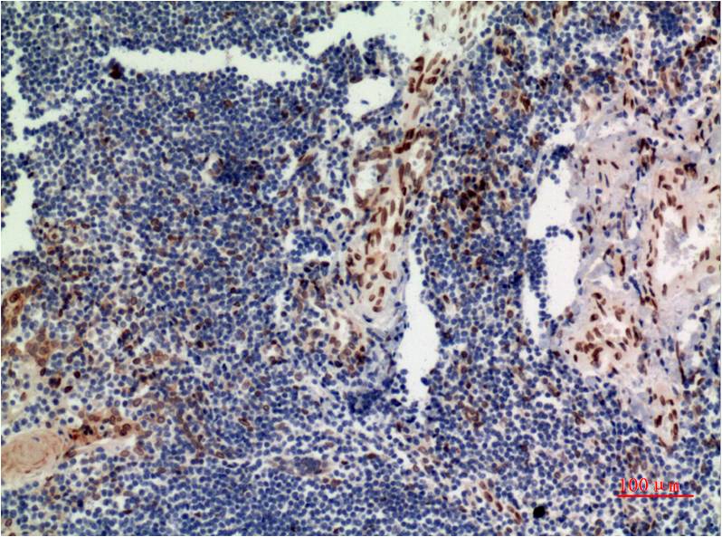 Anti-ERK1 Mouse mAb [65M76L14]