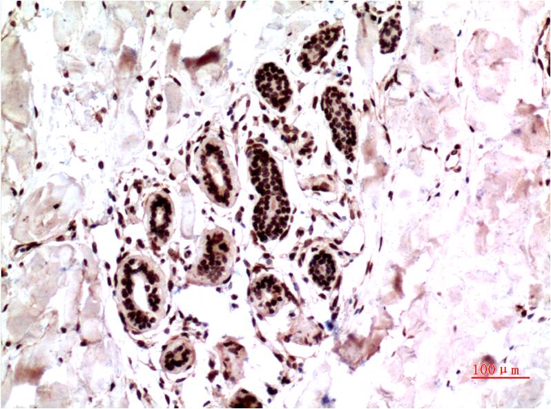 Anti-ERK1 Mouse mAb [65M76L14]