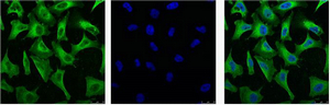 Anti-EGFR Mouse mAb [75M96L67]