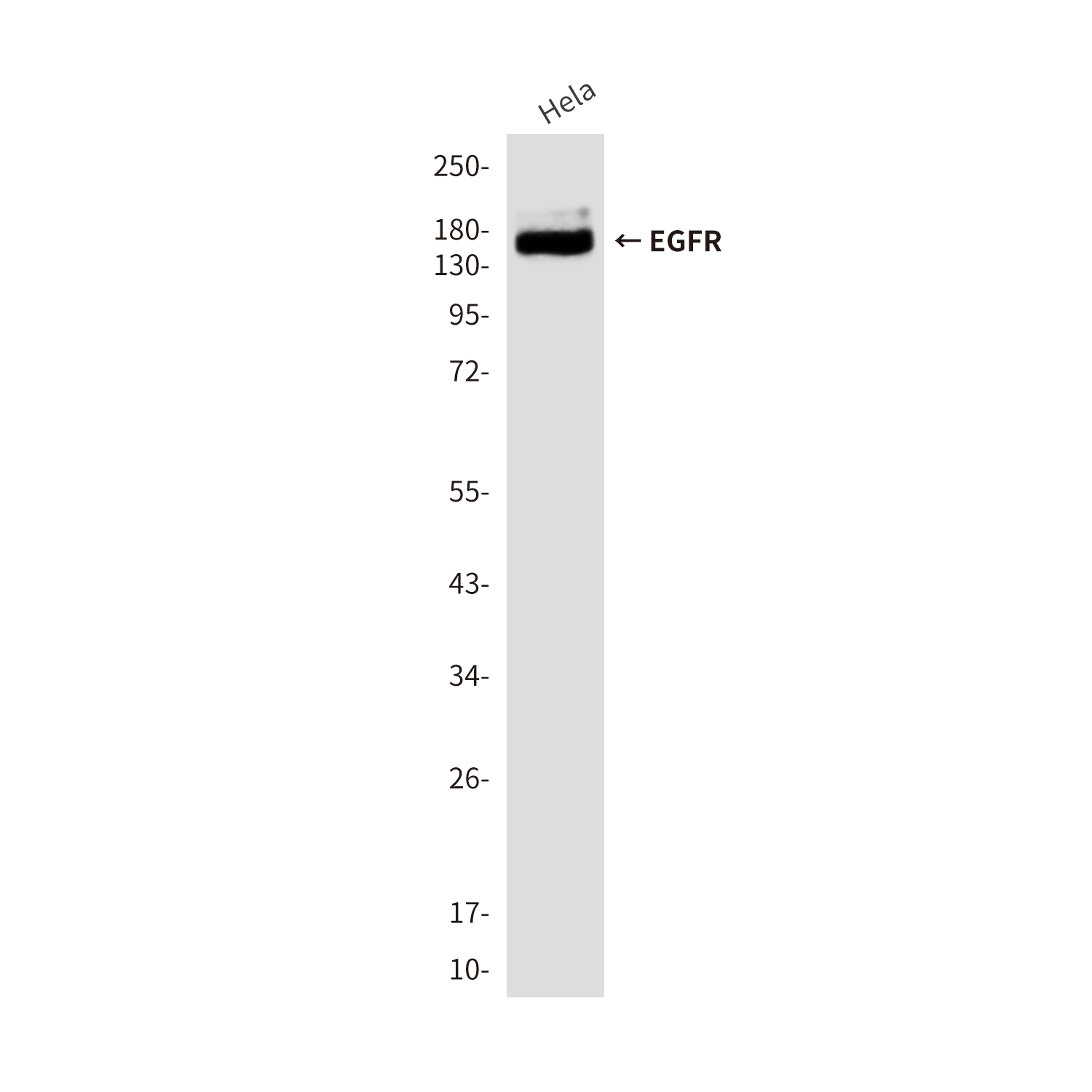 Anti-EGFR Mouse mAb [75M96L67]
