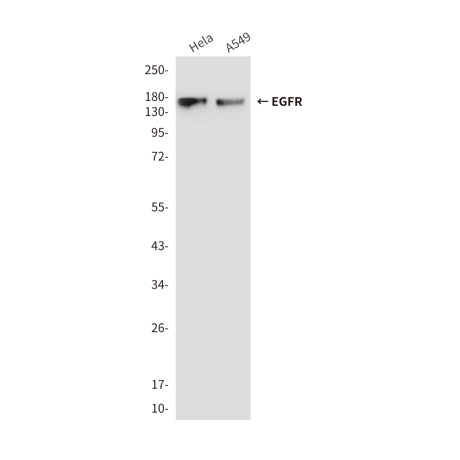 Anti-EGFR Mouse mAb [75M96L67]
