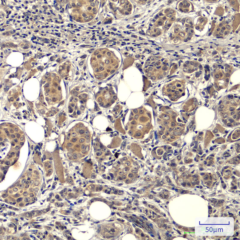 Anti-EGFR Mouse mAb [75M96L67]