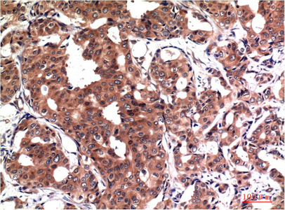 Anti-GSK3 beta Mouse mAb [82L95K12]