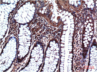 Anti-GSK3 beta Mouse mAb [82L95K12]