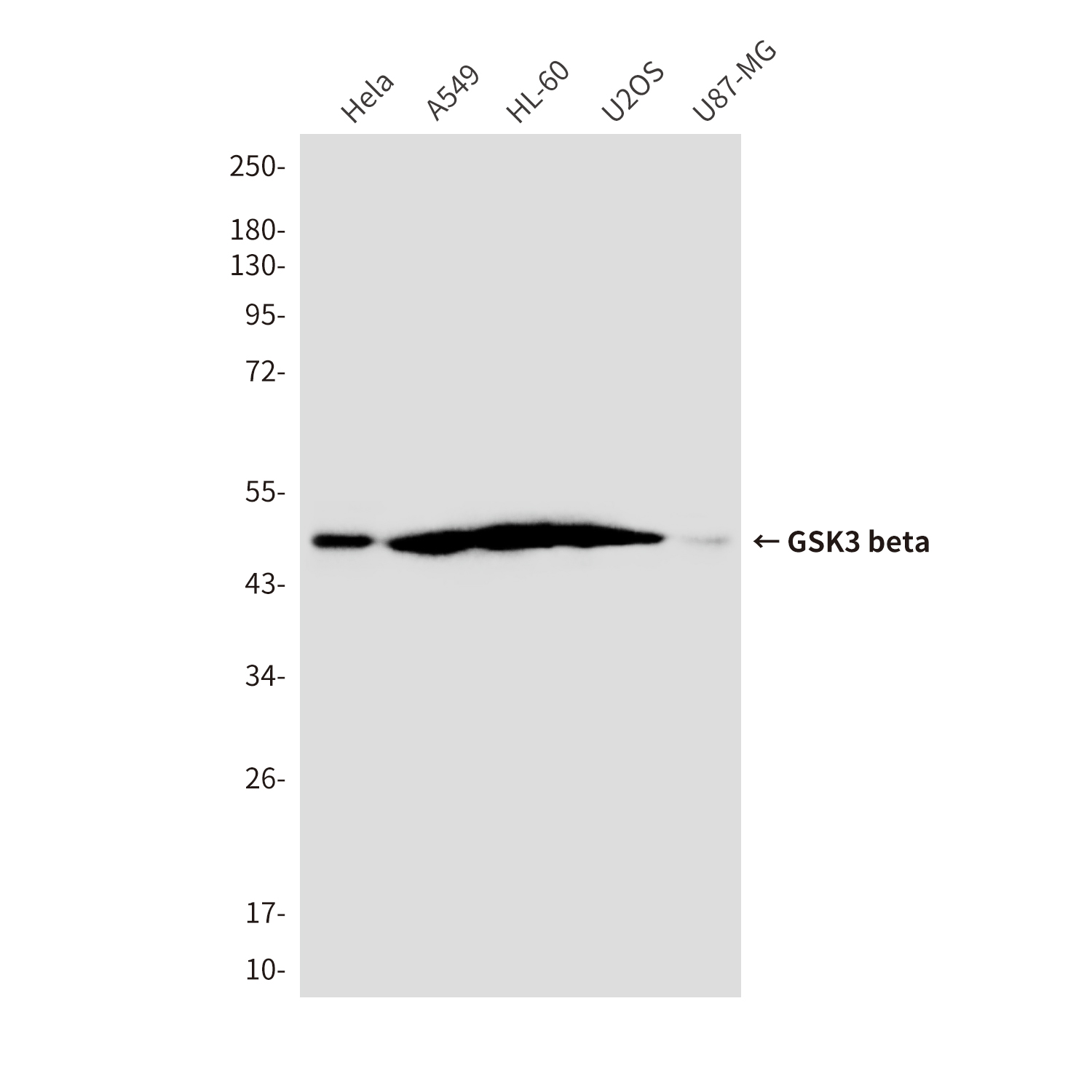 Anti-GSK3 beta Mouse mAb [82L95K12]
