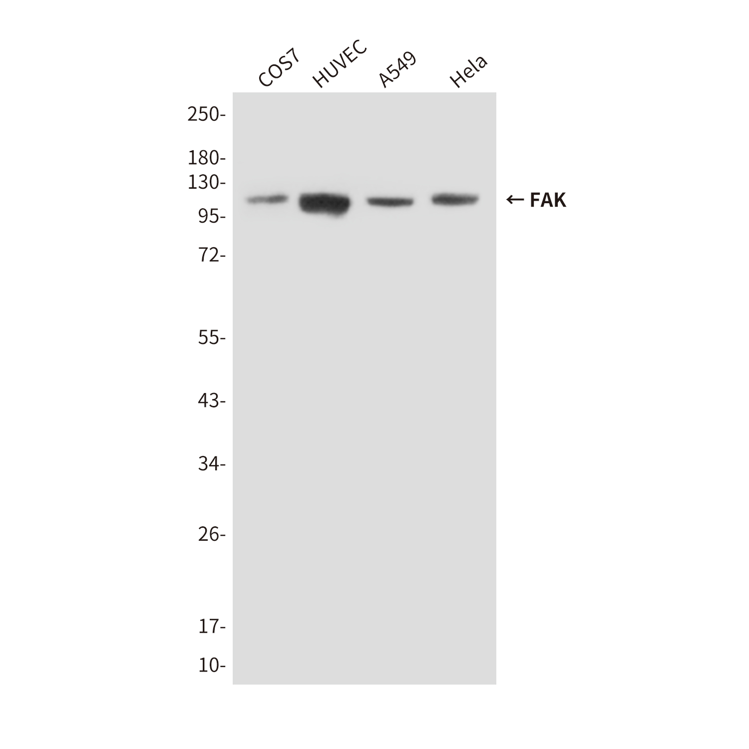Anti-FAK Mouse mAb [80K45K11]