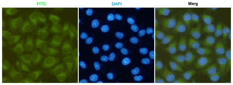 Anti-FAK Mouse mAb [80K45K11]