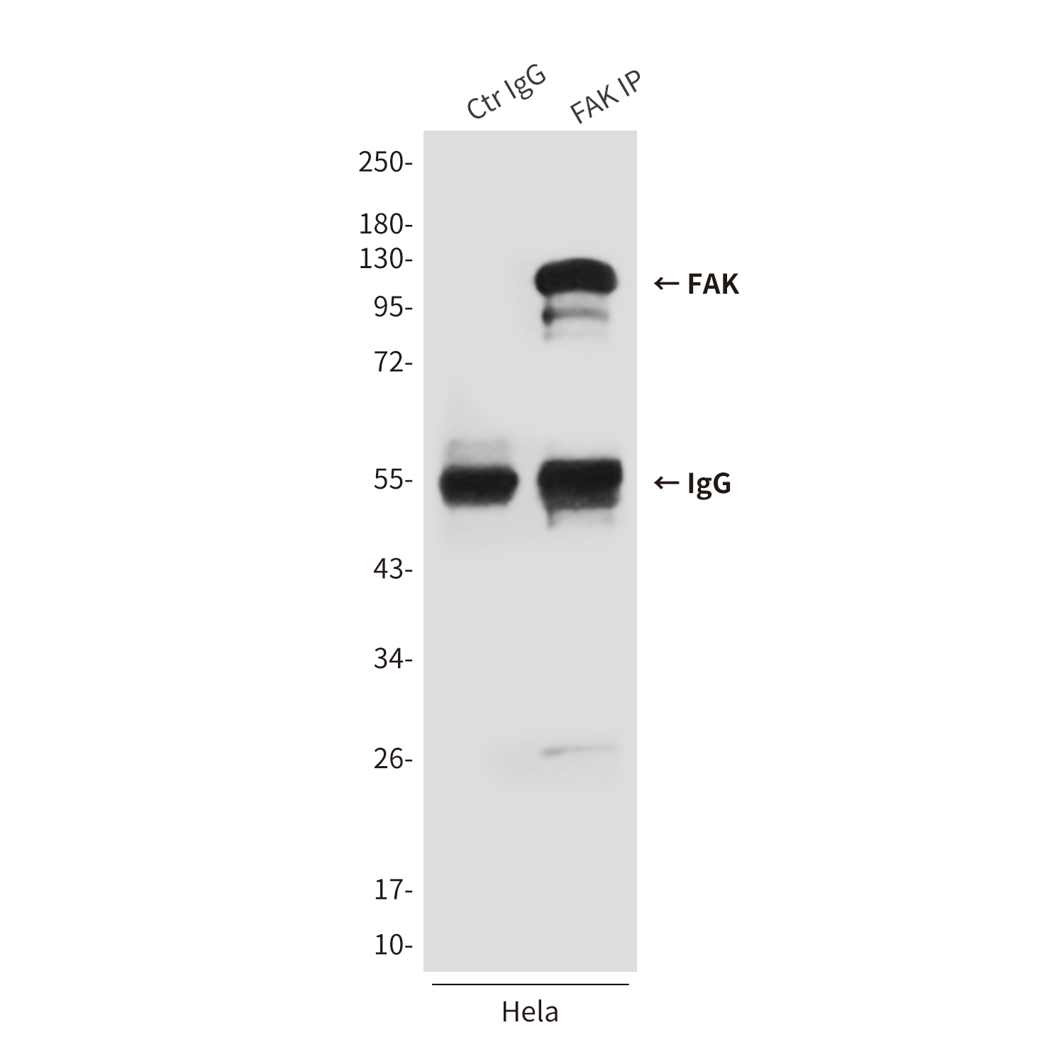 Anti-FAK Mouse mAb [80K45K11]