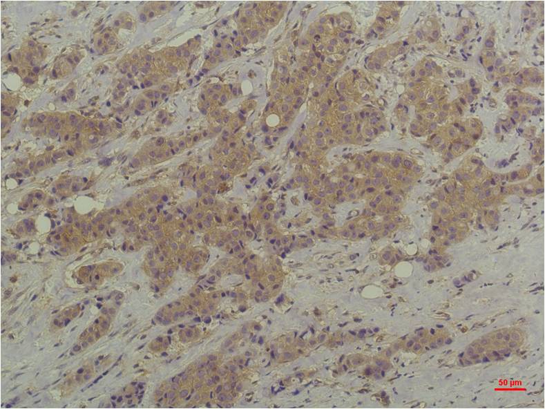 Anti-ERK1/2 Mouse mAb [27K91K62]