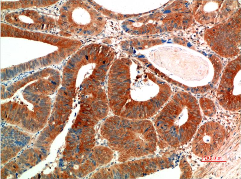Anti-Phospho-ERK1/2 (Tyr222/Tyr205) Mouse mAb [76M92M37]