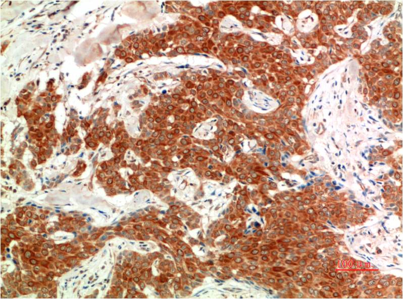 Anti-Phospho-ERK1/2 (Tyr222/Tyr205) Mouse mAb [76M92M37]