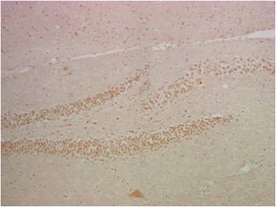 Anti-NF-KB p65 Mouse mAb [14K34M31]