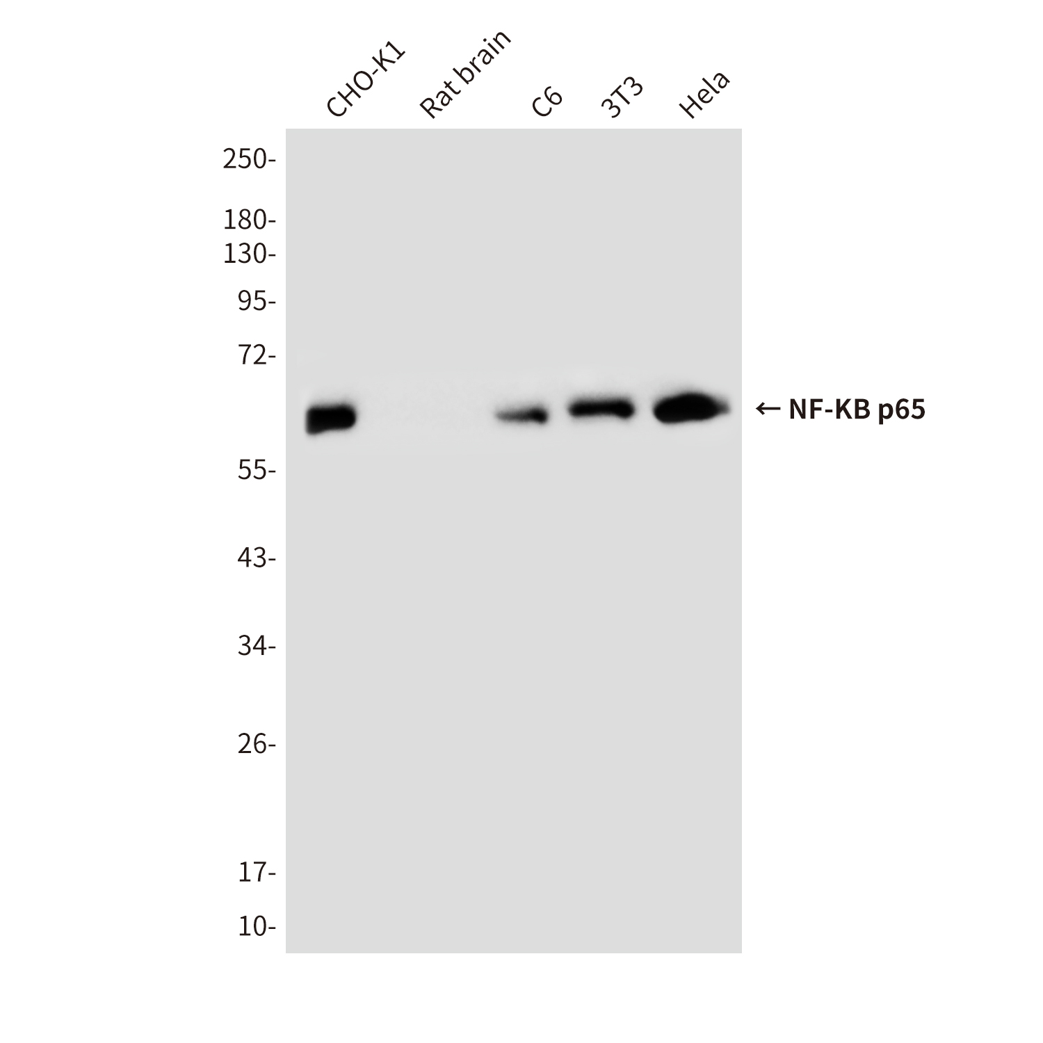 Anti-NF-KB p65 Mouse mAb [14K34M31]
