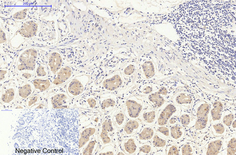 Anti-DDIT3 Mouse mAb [65K42L69]