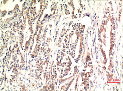 Anti-DDIT3 Mouse mAb [65K42L69]