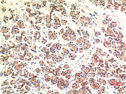 Anti-DDIT3 Mouse mAb [65K42L69]