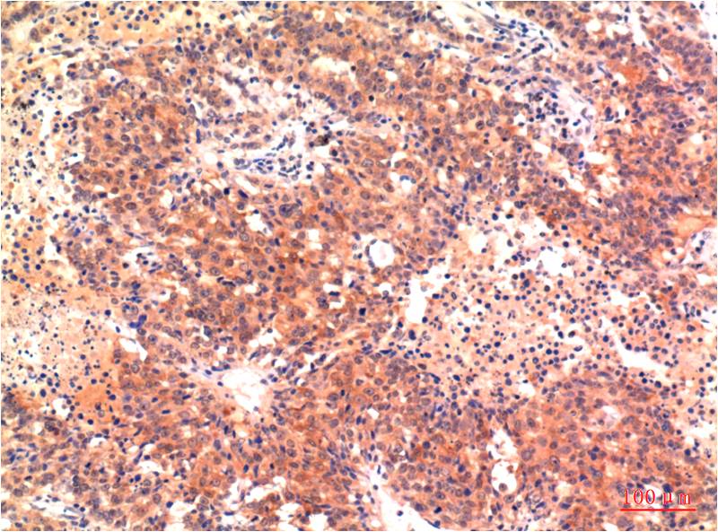 Anti-LC3A Mouse mAb [88K45K84]