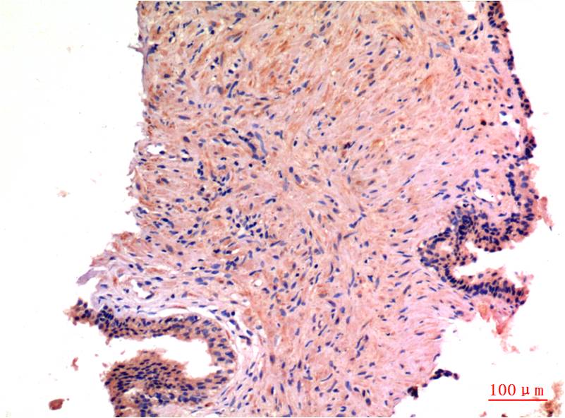 Anti-LC3A Mouse mAb [88K45K84]