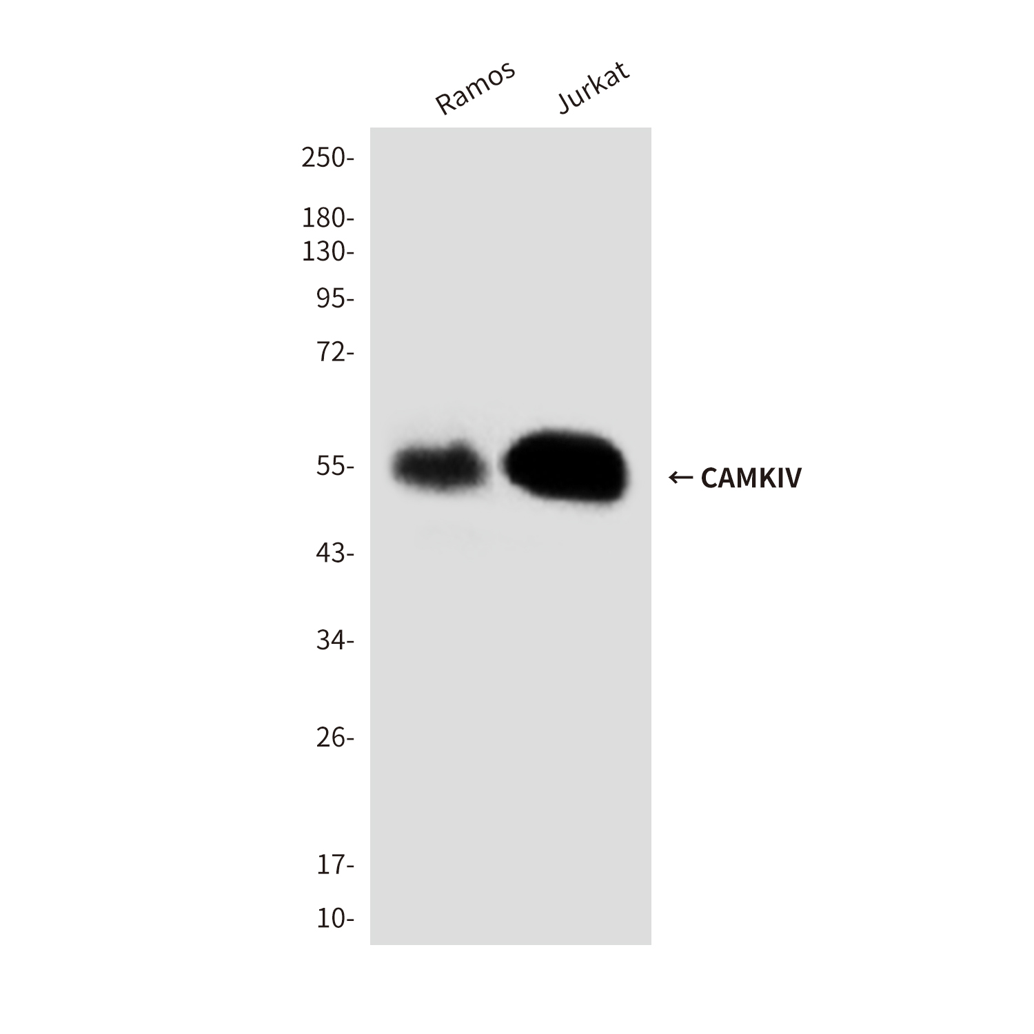 Anti-CAMKIV Mouse mAb [39M91M53]