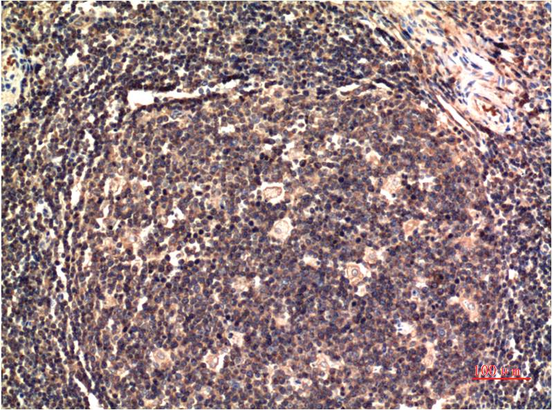 Anti-ERK1 Mouse mAb [90M30K93]