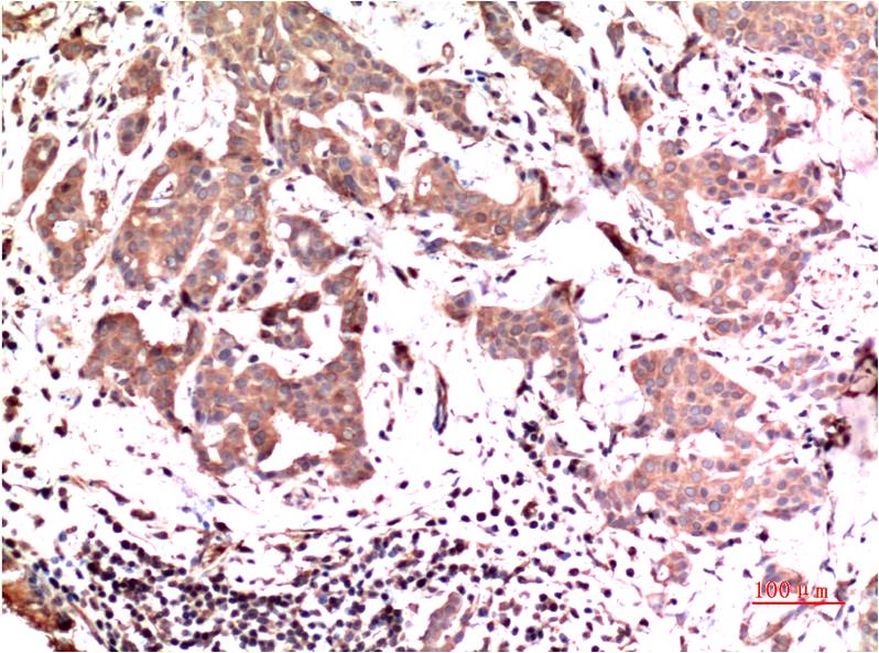 Anti-ERK1 Mouse mAb [90M30K93]