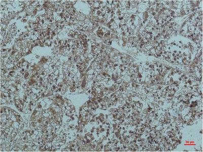 Anti-Smad2/3 Mouse mAb [82L23L50]