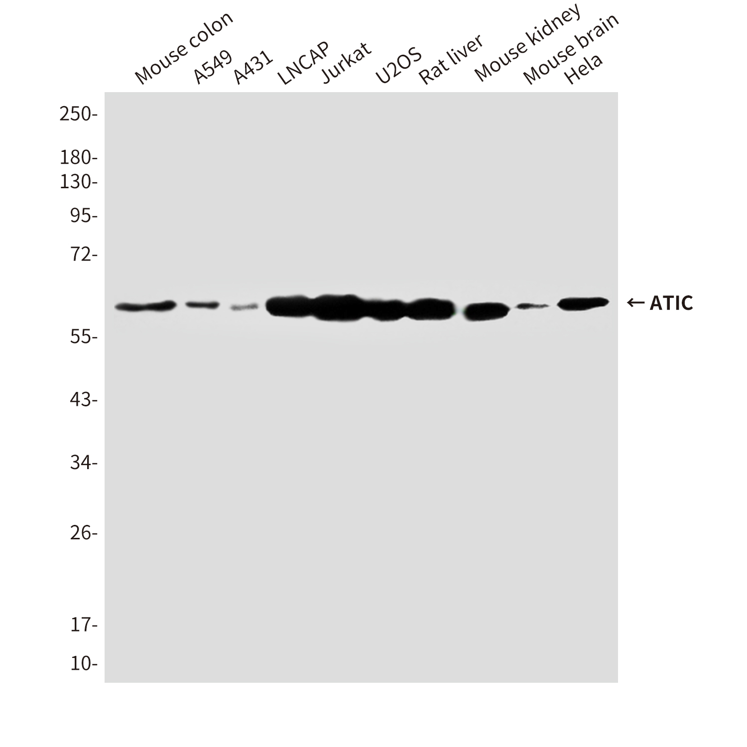 Anti-ATIC Mouse mAb [51L03L03]