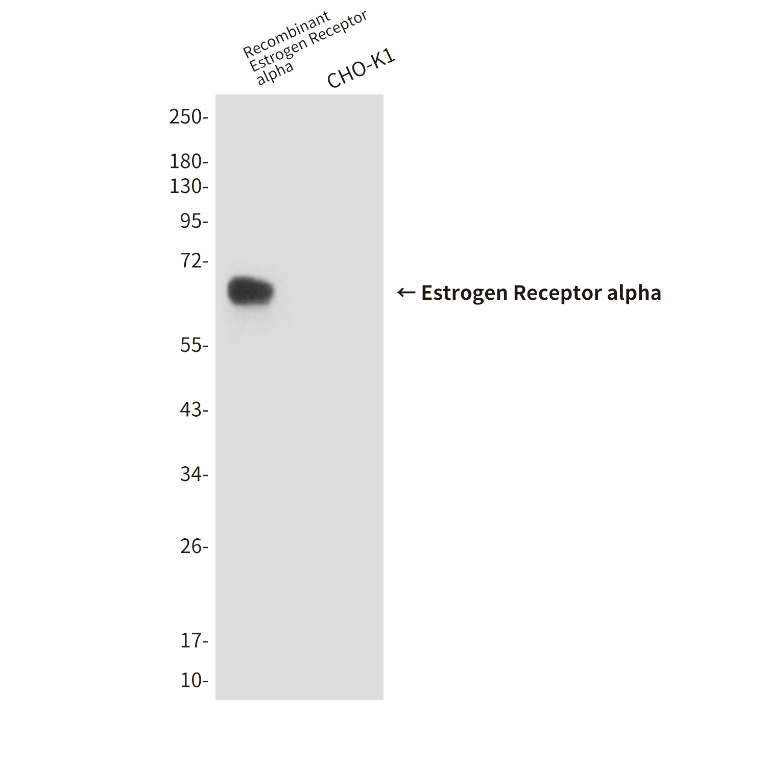 Anti-Estrogen Receptor alpha Mouse mAb [97M67L34]