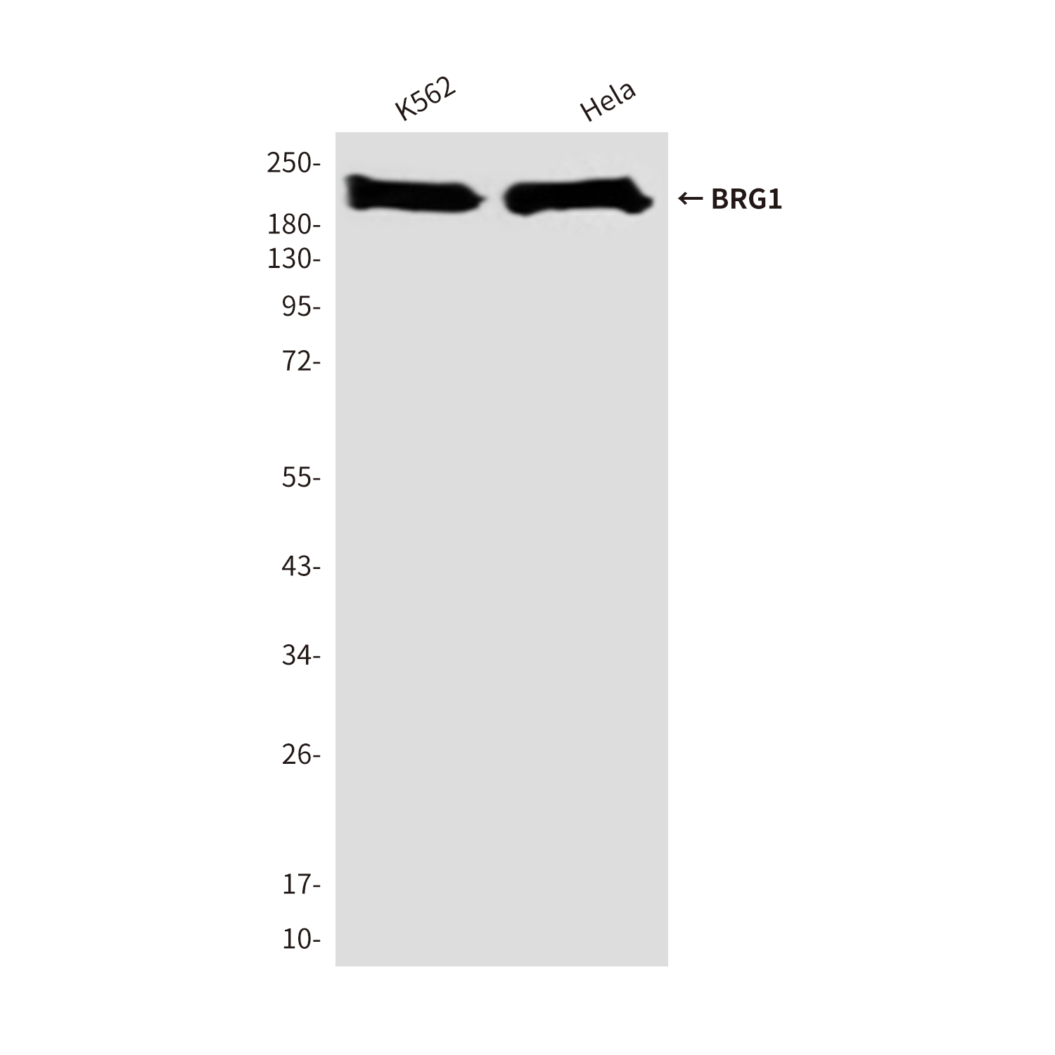 Anti-BRG1 Mouse mAb [68L89L36]