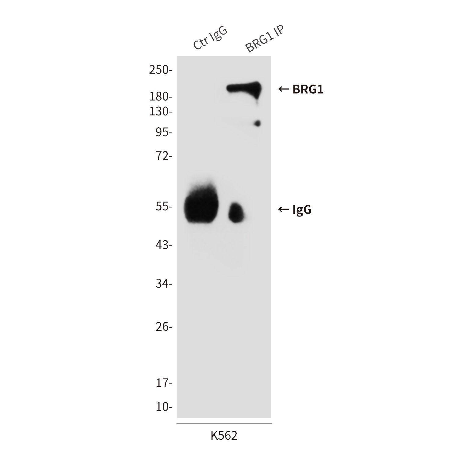 Anti-BRG1 Mouse mAb [68L89L36]