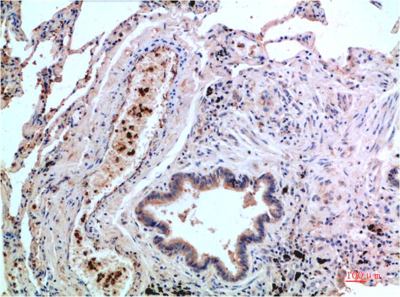 Anti-p38 Mouse mAb [50L90L82]