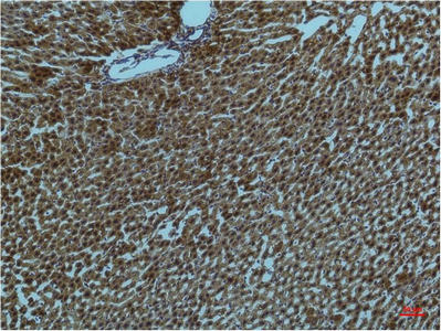 Anti-PI3 Kinase p85 alpha Mouse mAb [31L18M14]