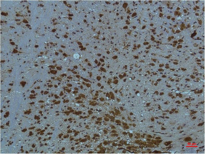 Anti-PI3 Kinase p85 alpha Mouse mAb [31L18M14]