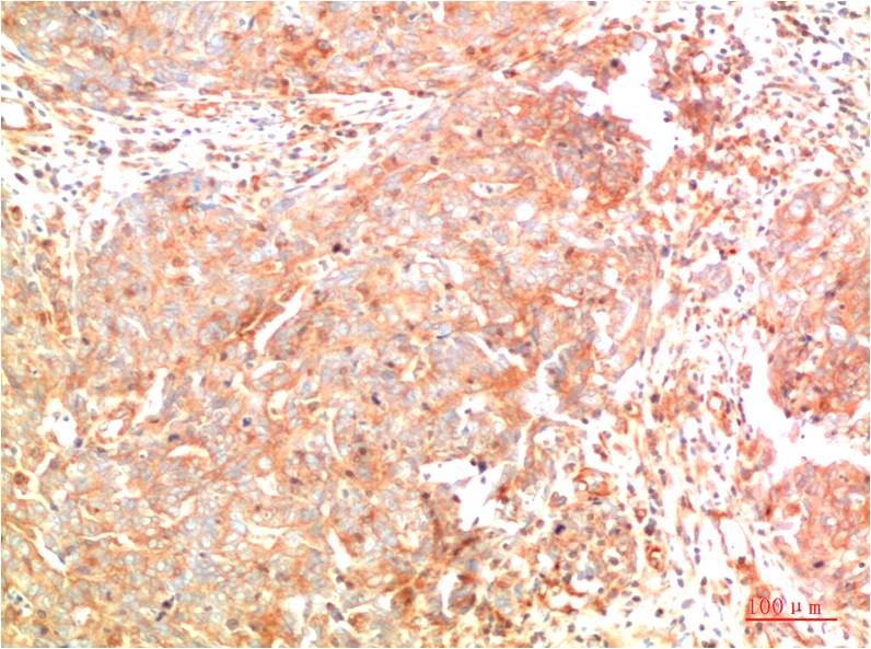 Anti-ATG7 Mouse mAb [18M51M93]