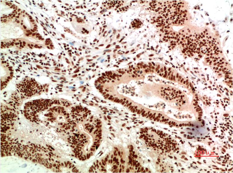 Anti-ATM Mouse mAb [13K68M26]