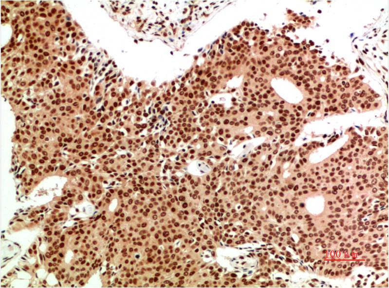 Anti-ATM Mouse mAb [13K68M26]