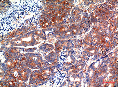 Anti-GSK3 beta Mouse mAb [84M15M73]