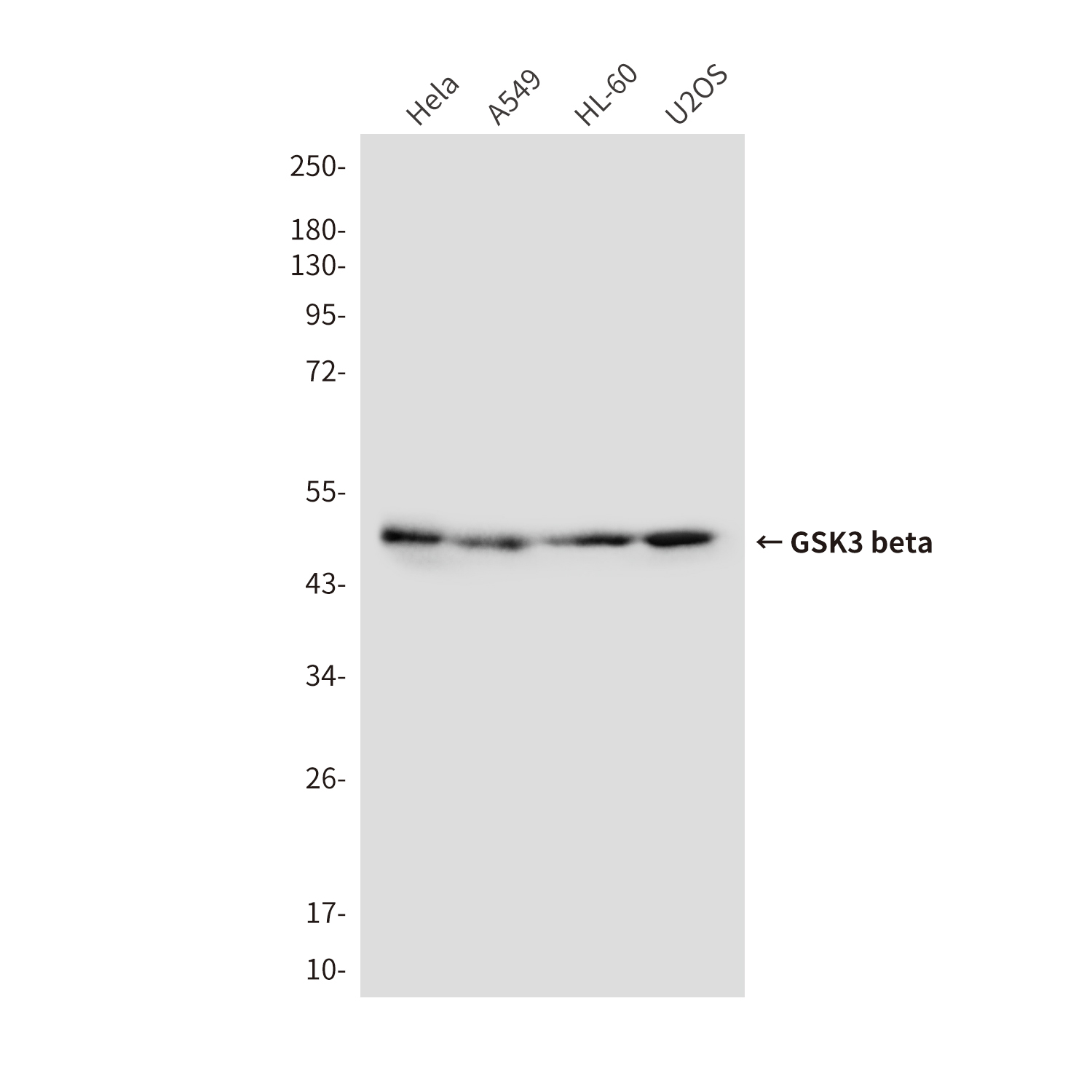 Anti-GSK3 beta Mouse mAb [84M15M73]